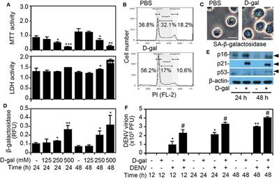 Senescence in Monocytes Facilitates Dengue Virus Infection by Increasing Infectivity